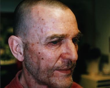 2002